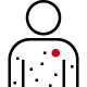 Icon of heat illness with rash